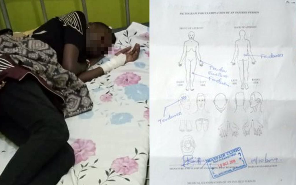 Vítima de agressão em hospital da Uganda; ao lado, avaliação médica das lesões após agressão (Foto: Reprodução)