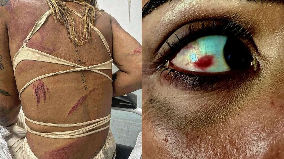 Ariela Nascimento foi covardemente agredida por cinco homens cis (Fotos: Reprodução/Instagram)